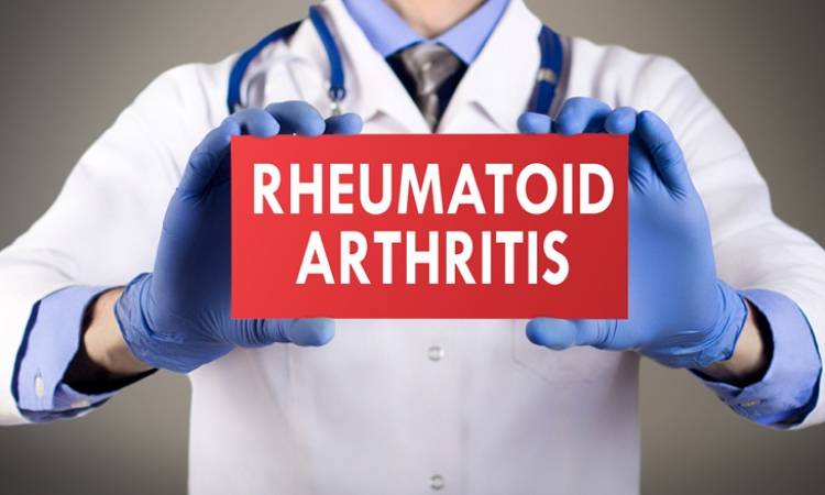 How to Reduce Costs for Rheumatoid Arthritis Treatment