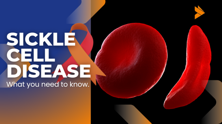 Sickle Cell Disease