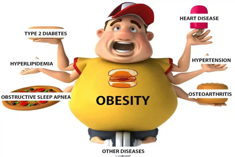 The Financial Implications of Obesity-Related Illnesses