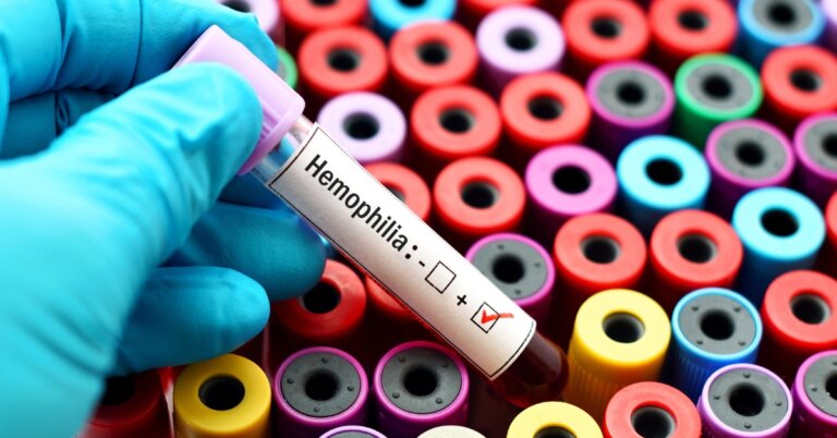 The Economic Burden of Hemophilia and Bleeding Disorders