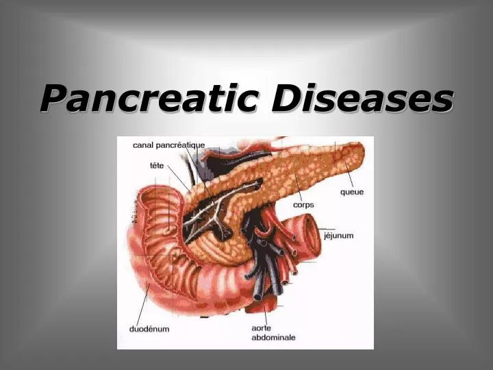 The Financial Burden of Pancreatic Diseases and Treatments